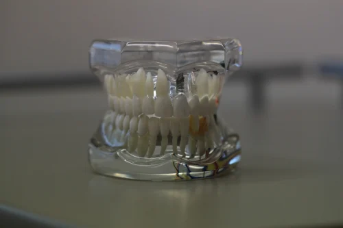 Lee más sobre el artículo Implantes dentales bajo el agua