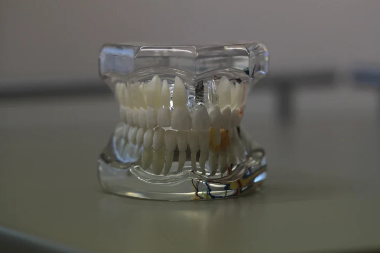 Lee más sobre el artículo Implantes dentales bajo el agua